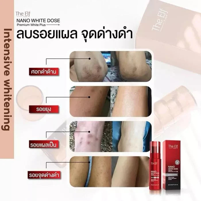 The Elf Nano White Dose Advanced Skin Serum - 60mL