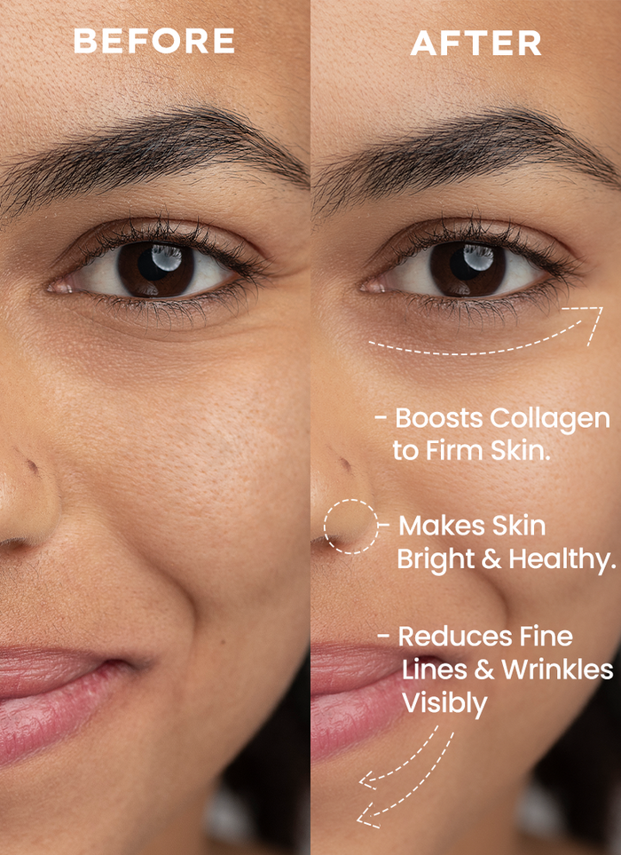 Hyphen 0.05% Retinal Reset Serum - clinical results chart and benefit claims