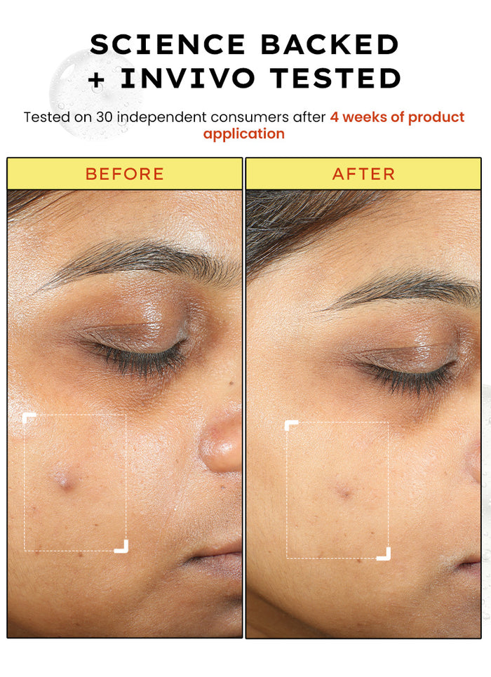 Hyphen 10% Vitamin C Serum with 1% [vitamin E + Ferulic Acid] - ingredient synergy and formulation chart