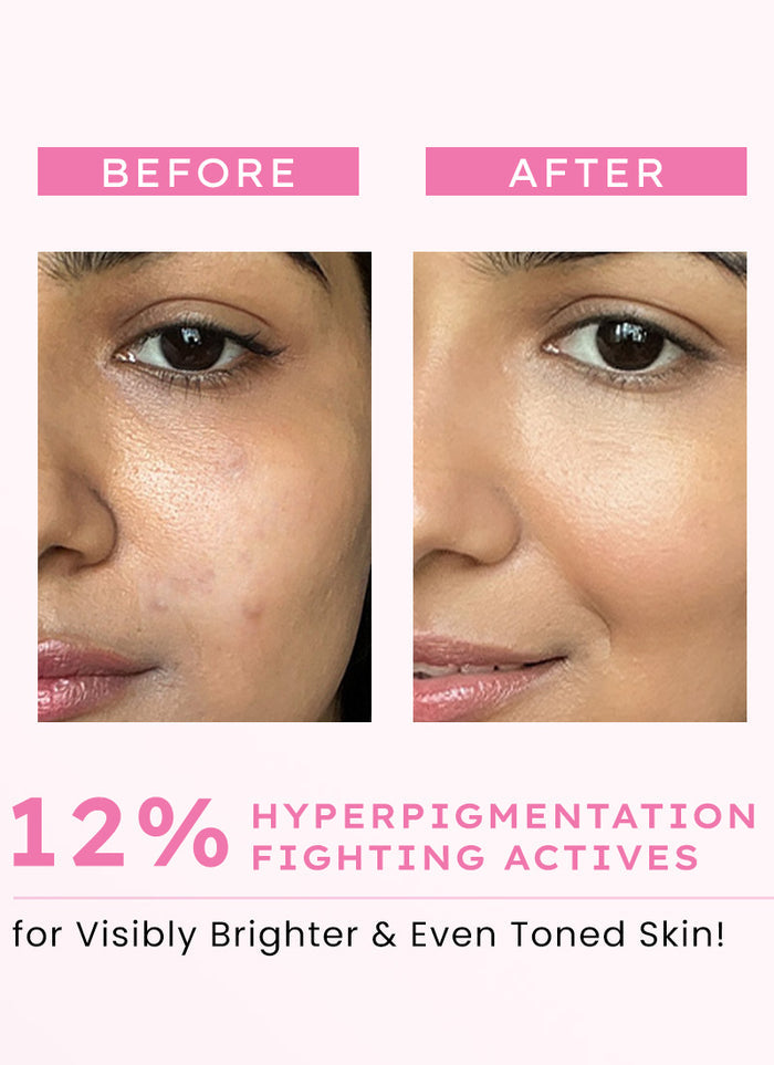 Hyphen Advanced Glow Serum With 3% Tranexamic Acid & 2% Kojic Acid - clinical results chart and benefit claims
