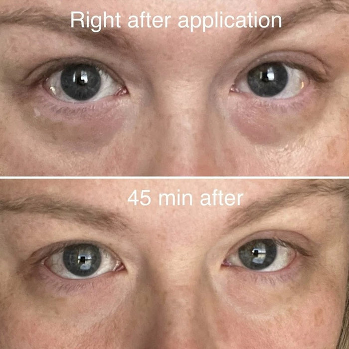 AE PLASTISCHE CHIRURGIE AE提亮重塑眼霜 30g Remodelling Eye Cream