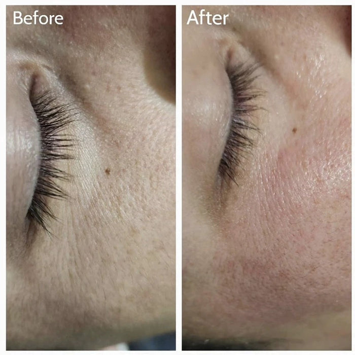 AE PLASTISCHE CHIRURGIE AE提亮重塑眼霜 30g Remodelling Eye Cream