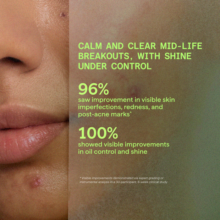 Advertisement for skincare product showing a close-up of skin with text highlighting results.