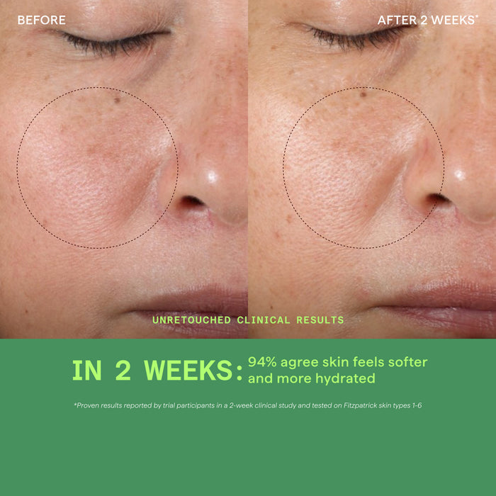 Before and after comparison of skin texture on a person's face with a green banner displaying clinical results.