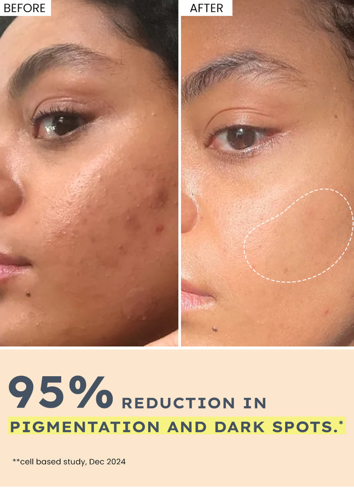 Hyphen Brightening Serum Pads with 44% Rice Water - 50 pads - how to use directions and skincare routine fit