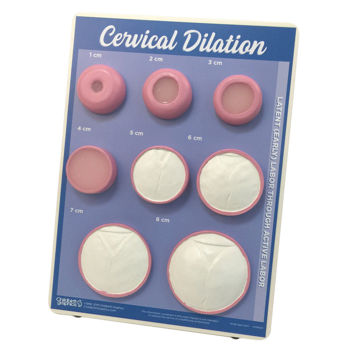A model displays eight circular stages of cervical dilation, from 1 to 8 centimeters, on a board; the sizes are labeled and the later stages show a Y-shaped opening.