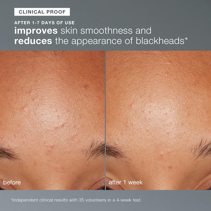 daily microfoliant exfoliator clinical