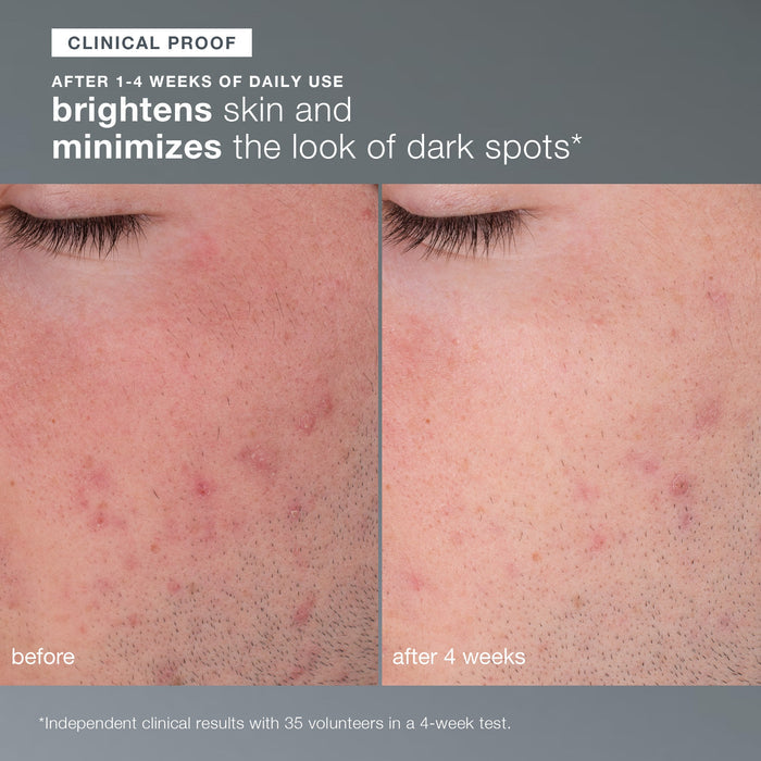daily microfoliant exfoliator clinical