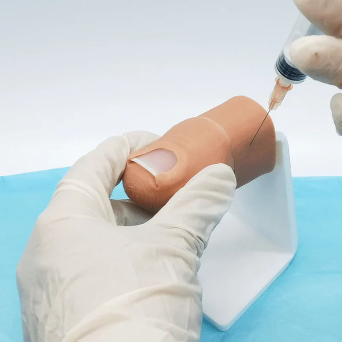 Ingrown Toenail Surgical Simulator (Onychocryptosis)