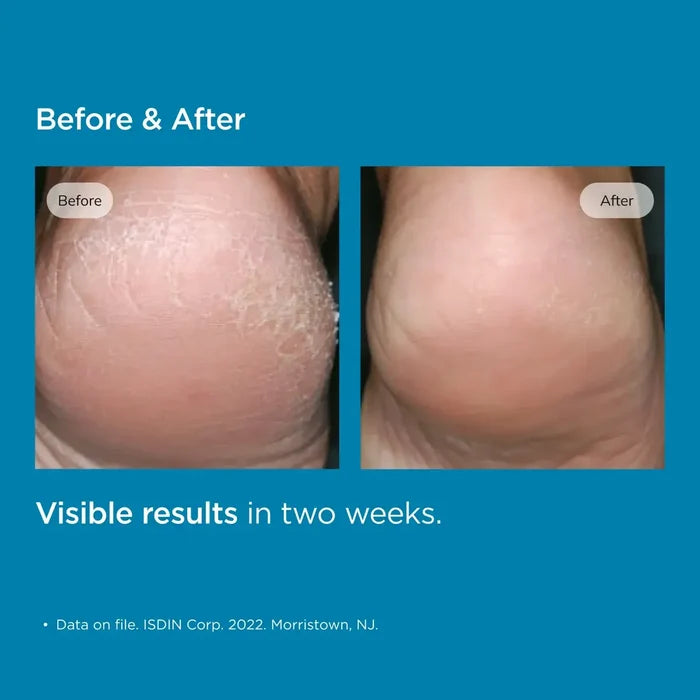 ISDIN Uradin® Podos Gel Oil