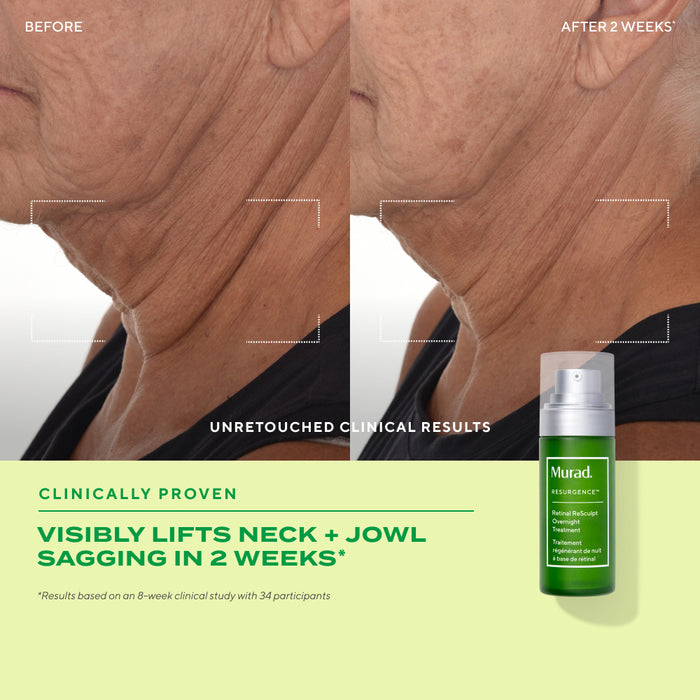 retinal resculpt overnight treatment before and after showing older woman with visibly lifted neck + jowl sagging over 2 weeks