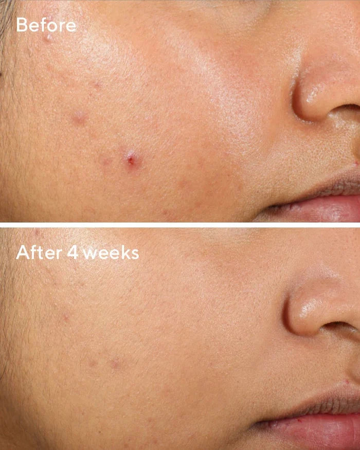 Murad Clarifying Water Gel