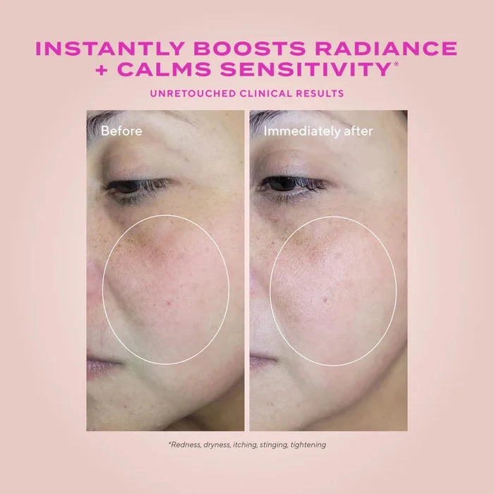 Murad Heartleaf Gentle Resurfacing Serum