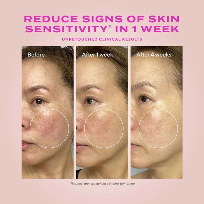 Murad Heartleaf Gentle Resurfacing Serum