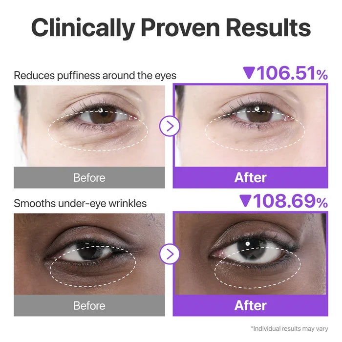 Numbuzin No.9 NAD Collagen Under Eye Patches (5 Pairs) | GlamTouch UK