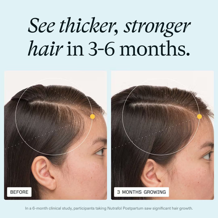 Nutrafol Postpartum Hair Growth Nutraceutical Supplement