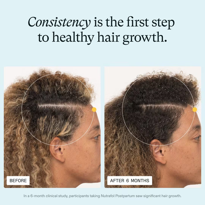 Nutrafol Postpartum Hair Growth Nutraceutical Supplement