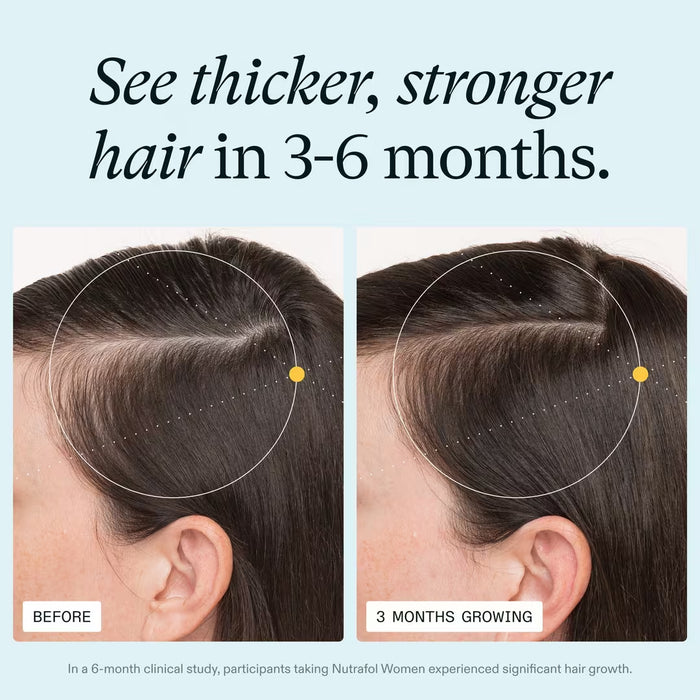 Nutrafol Women’s Hair Growth Nutraceutical Supplement
