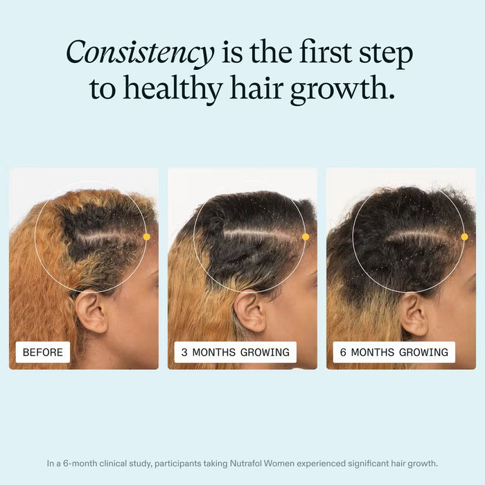 Nutrafol Women’s Hair Growth Nutraceutical Supplement