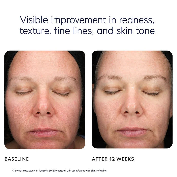PCA Skin Triple Exfoliation Peel Pads