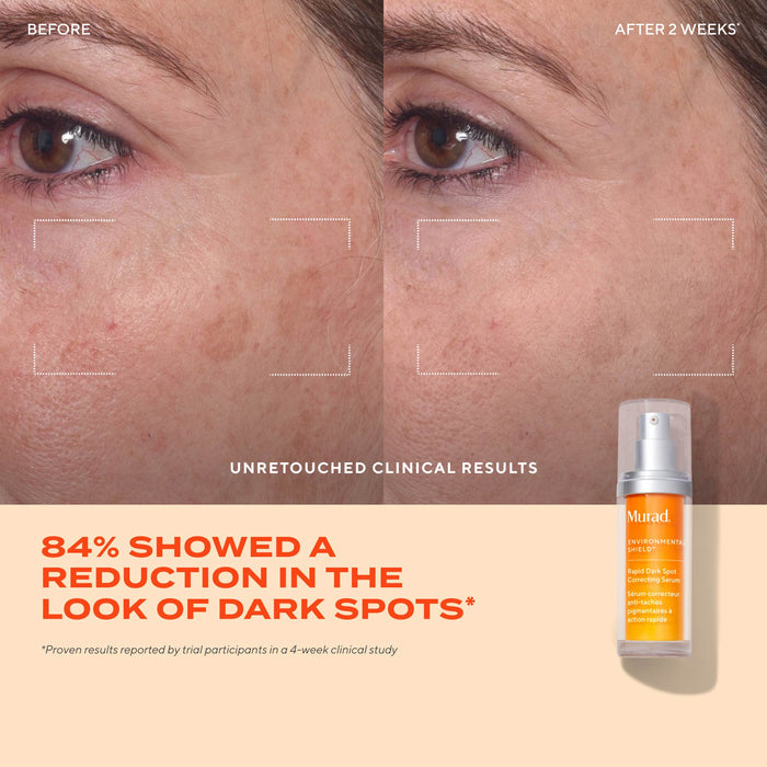 Rapid Dark Spot Correcting Serum Travel Size