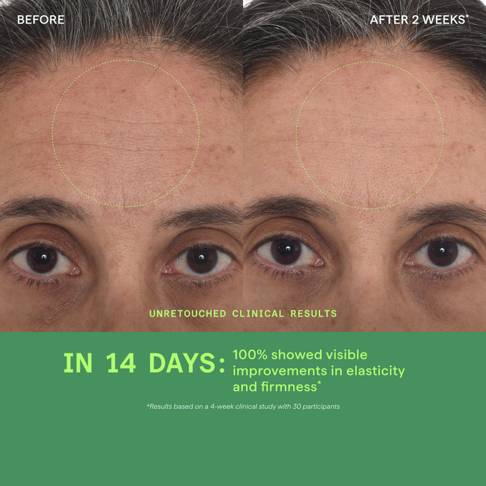 Before-and-after clinical results comparison of a woman's forehead and eyes after 2 weeks and 14 days, with a green text banner at the bottom reading 'IN 14 DAYS: 100% showed visible improvements in elasticity and firmness'.