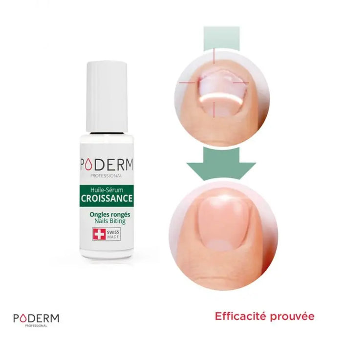Serum Treatment for Bitten Nails - 8ml - Growth - Poderm Professional