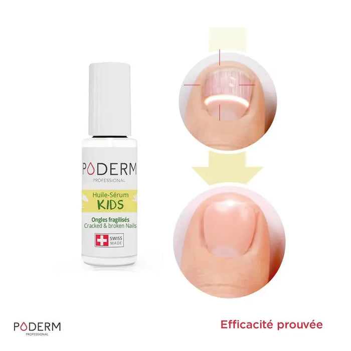 Serum Treatment for Damaged Nails - Children - 8ml - Poderm Professional