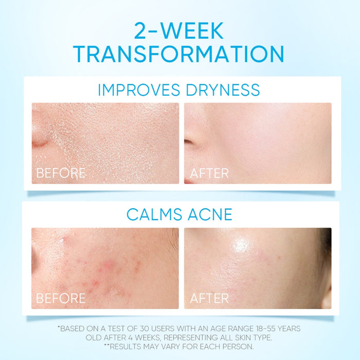 Skintific 5X Ceramide Facial Moisturizer for Oily Skin Care Collagen Niacinamide Acne Cream 30g