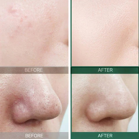 SOME BY MI AHA BHA PHA 30 Days Miracle Toner تونر البشرة المعجزة لعلاج الحبوب من سمباي مي
