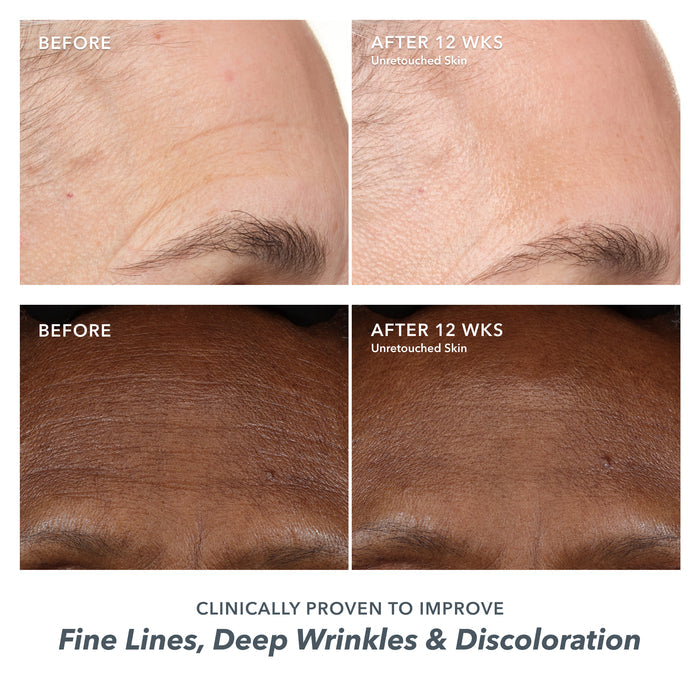 Supercharged Skincare Routine