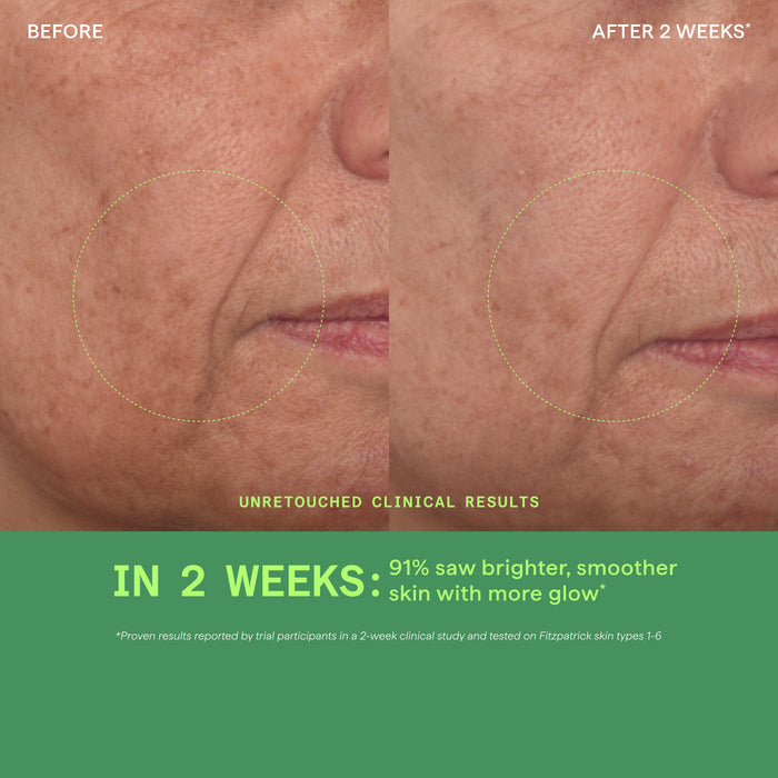 Before and after comparison of skin treatment showing smoother texture and brighter appearance.